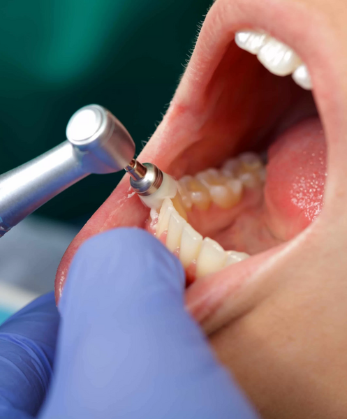 KirilovaDent, cabinet stomatologic non stop sector 6